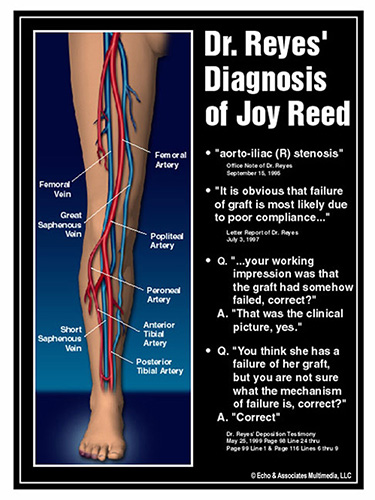 Artery Veins Diagram